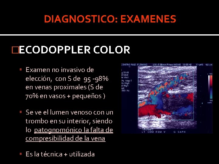 DIAGNOSTICO: EXAMENES �ECODOPPLER COLOR Examen no invasivo de elección, con S de 95 -98% DIAGNOSTICO: EXAMENES �ECODOPPLER COLOR Examen no invasivo de elección, con S de 95 -98%