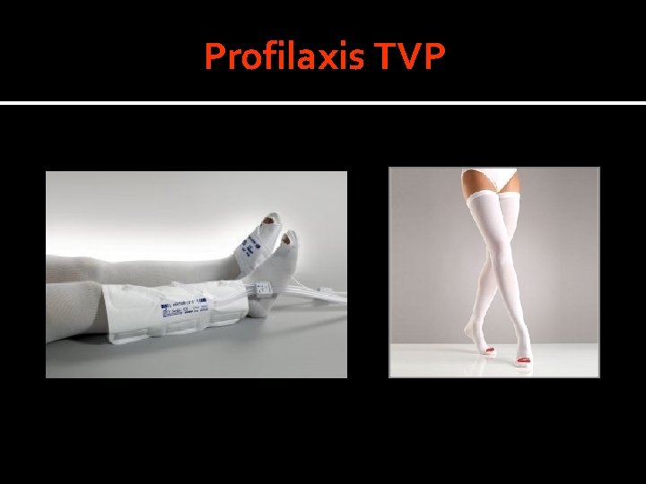 Profilaxis TVP Profilaxis TVP