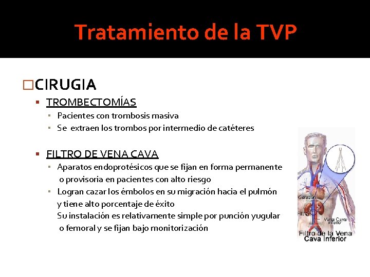 Tratamiento de la TVP �CIRUGIA TROMBECTOMÍAS ▪ Pacientes con trombosis masiva ▪ Se extraen Tratamiento de la TVP �CIRUGIA TROMBECTOMÍAS ▪ Pacientes con trombosis masiva ▪ Se extraen