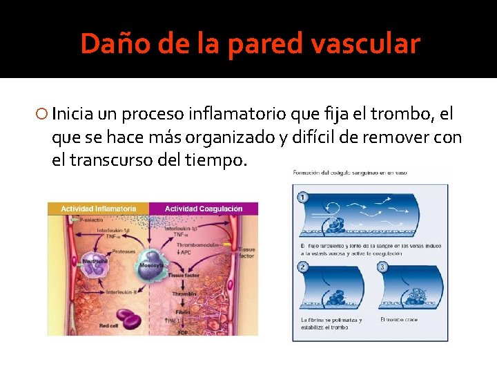 Daño de la pared vascular Inicia un proceso inflamatorio que fija el trombo, el Daño de la pared vascular Inicia un proceso inflamatorio que fija el trombo, el