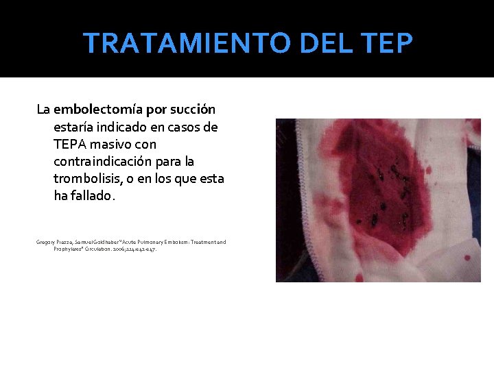 TRATAMIENTO DEL TEP La embolectomía por succión estaría indicado en casos de TEPA masivo TRATAMIENTO DEL TEP La embolectomía por succión estaría indicado en casos de TEPA masivo