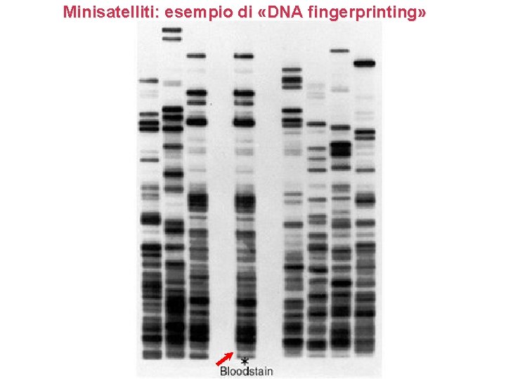Minisatelliti: esempio di «DNA fingerprinting» Minisatelliti: esempio di «DNA fingerprinting»