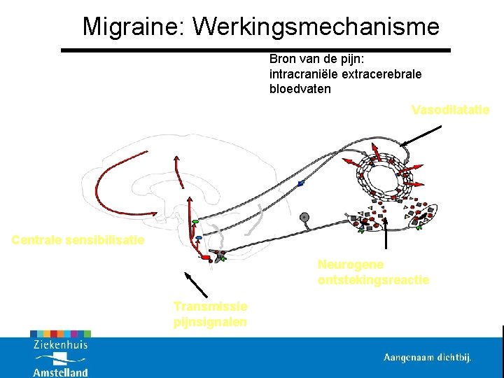 Migraine: Werkingsmechanisme Bron van de pijn: intracraniële extracerebrale bloedvaten Vasodilatatie Corte x Centrale sensibilisatie