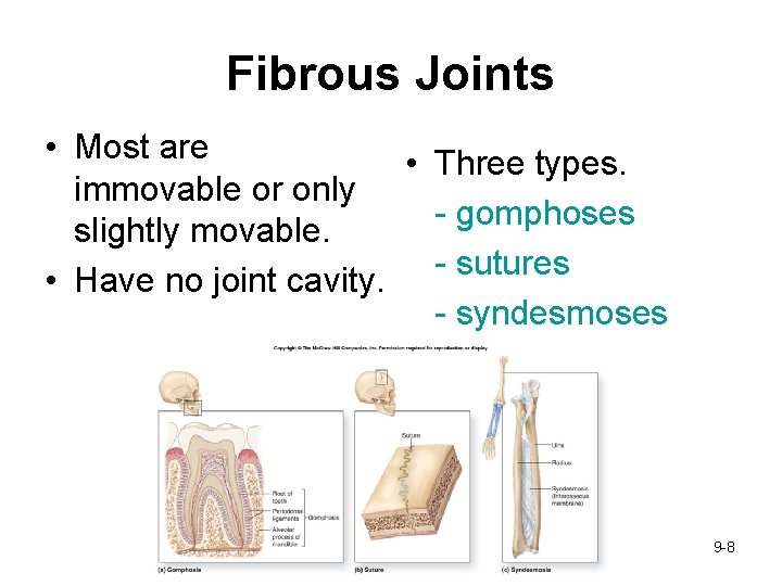 Fibrous Joints • Most are • Three types. immovable or only - gomphoses slightly