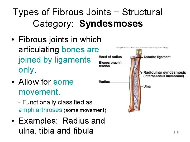 Types of Fibrous Joints − Structural Category: Syndesmoses • Fibrous joints in which articulating