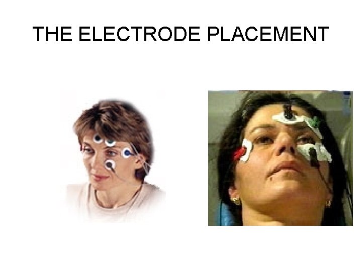 THE ELECTRODE PLACEMENT 