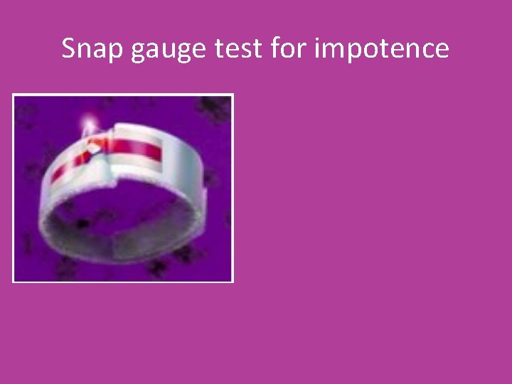 Snap gauge test for impotence 