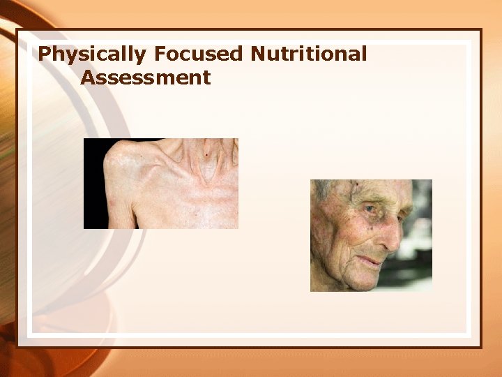 Physically Focused Nutritional Assessment 