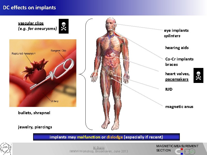 DC effects on implants vascular clips (e. g. for aneurysms) eye implants splinters orthopedic