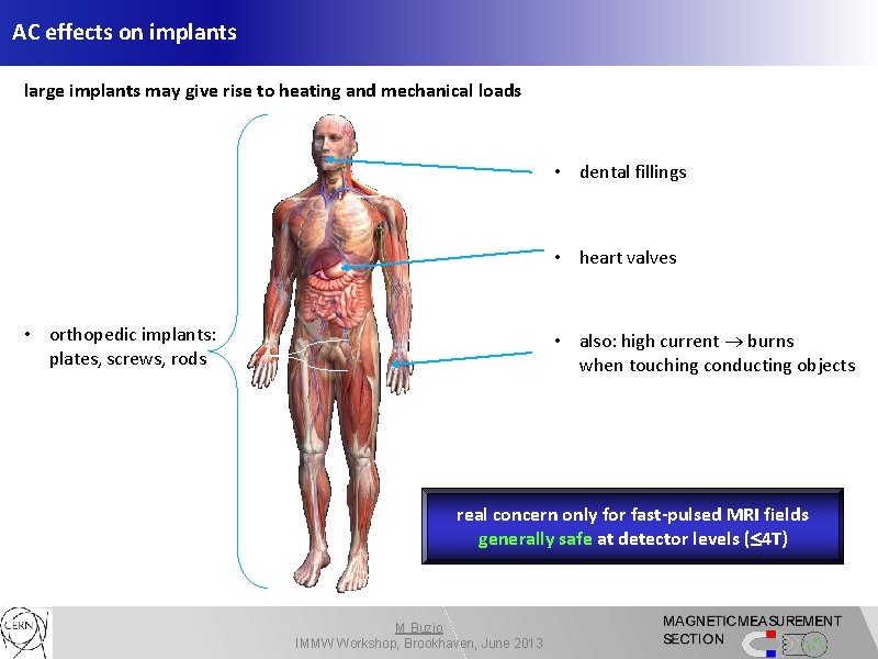 AC effects on implants large implants may give rise to heating and mechanical loads