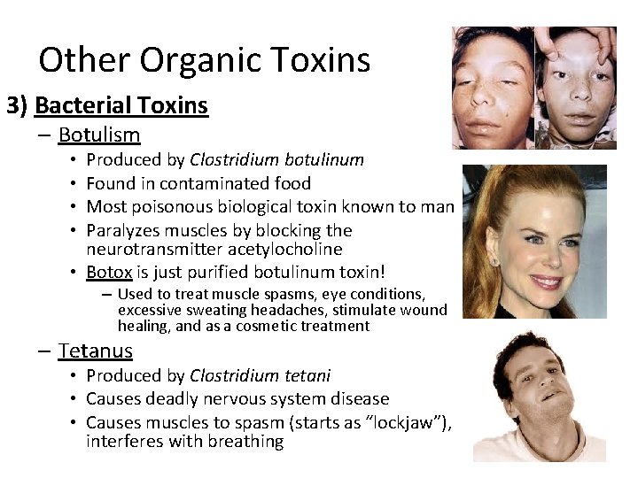 Other Organic Toxins 3) Bacterial Toxins – Botulism Produced by Clostridium botulinum Found in