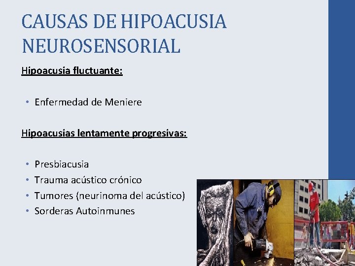 CAUSAS DE HIPOACUSIA NEUROSENSORIAL Hipoacusia fluctuante: • Enfermedad de Meniere Hipoacusias lentamente progresivas: •