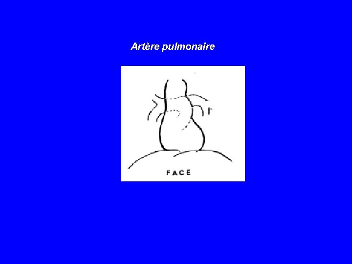 Artère pulmonaire 