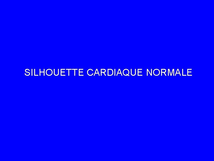 SILHOUETTE CARDIAQUE NORMALE 
