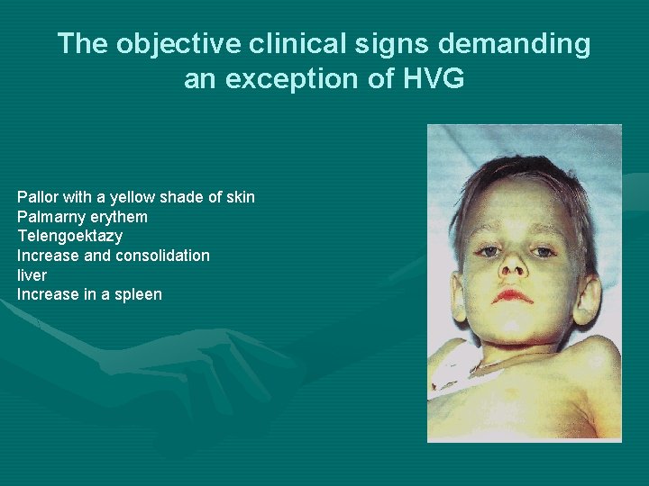 The objective clinical signs demanding an exception of HVG Pallor with a yellow shade