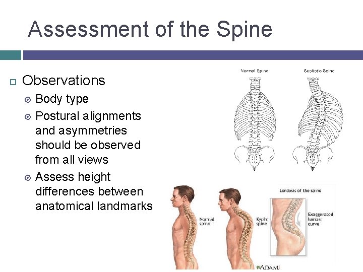 Assessment of the Spine Observations Body type Postural alignments and asymmetries should be observed