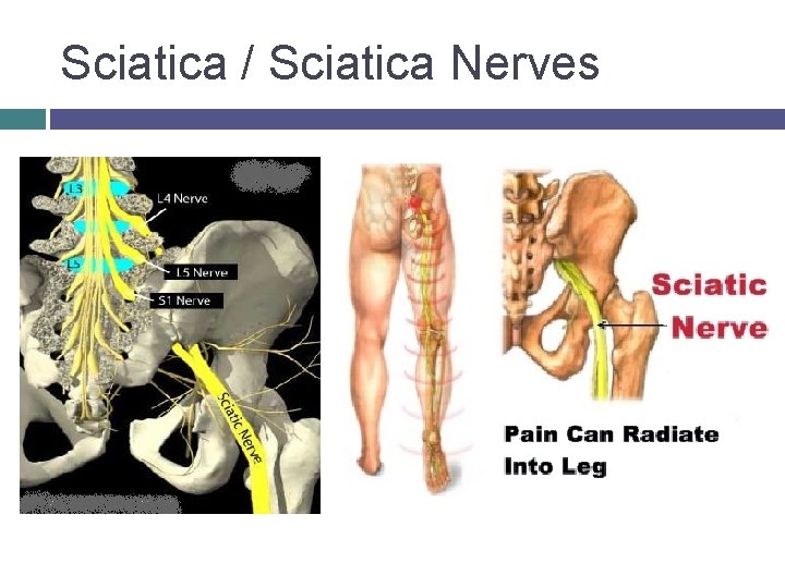 Sciatica / Sciatica Nerves © 2007 Mc. Graw-Hill Higher Education. All rights reserved. 