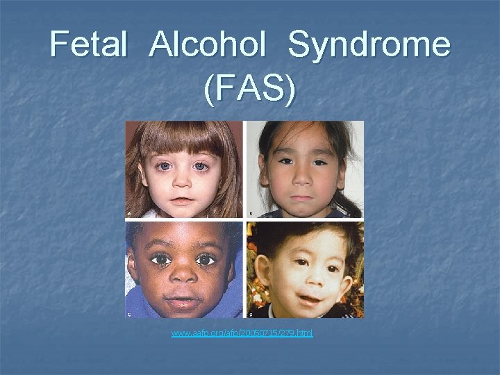 Fetal Alcohol Syndrome (FAS) www. aafp. org/afp/20050715/279. html Fetal Alcohol Syndrome (FAS) www. aafp. org/afp/20050715/279. html