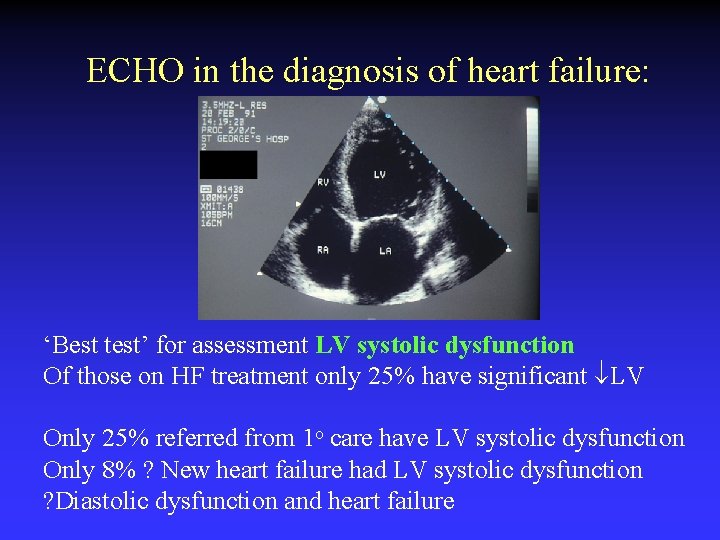 ECHO in the diagnosis of heart failure: ‘Best test’ for assessment LV systolic dysfunction