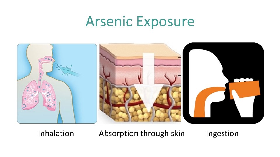 Arsenic Exposure Inhalation Absorption through skin Ingestion 