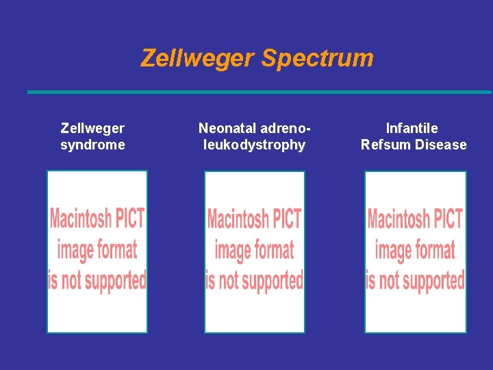 Zellweger Spectrum Zellweger syndrome Neonatal adrenoleukodystrophy Infantile Refsum Disease 