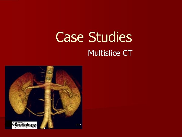 Case Studies Multislice CT 