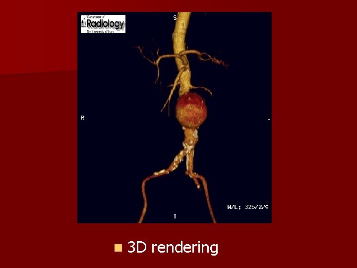 n 3 D rendering 