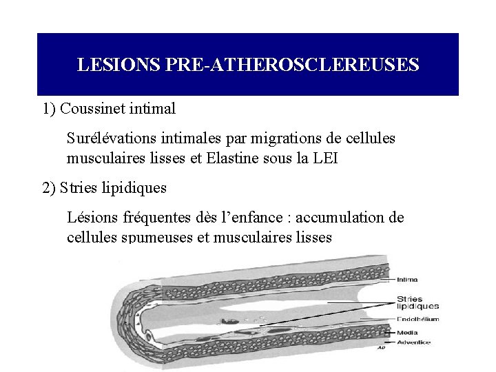 LESIONS PRE-ATHEROSCLEREUSES 1) Coussinet intimal Surélévations intimales par migrations de cellules musculaires lisses et
