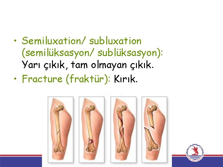  • Semiluxation/ subluxation (semilüksasyon/ sublüksasyon): Yarı çıkık, tam olmayan çıkık. • Fracture (fraktür):