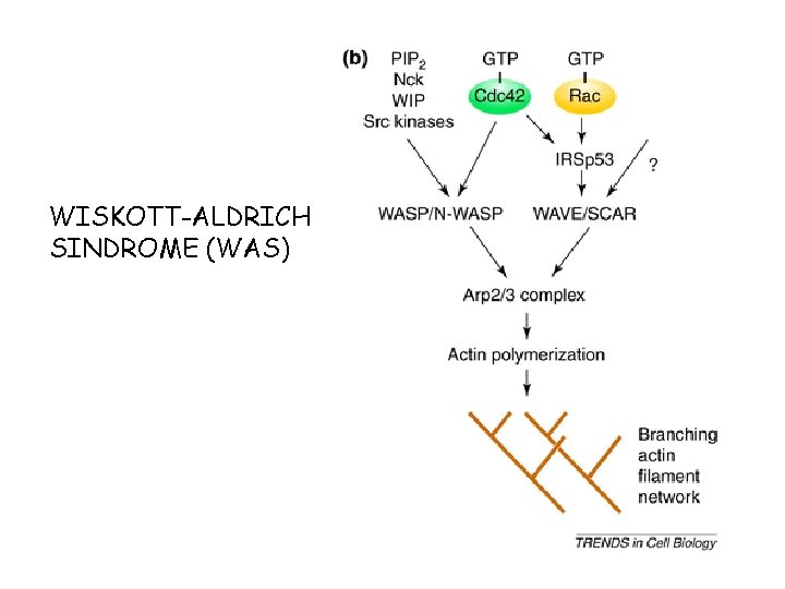 WISKOTT-ALDRICH SINDROME (WAS) 