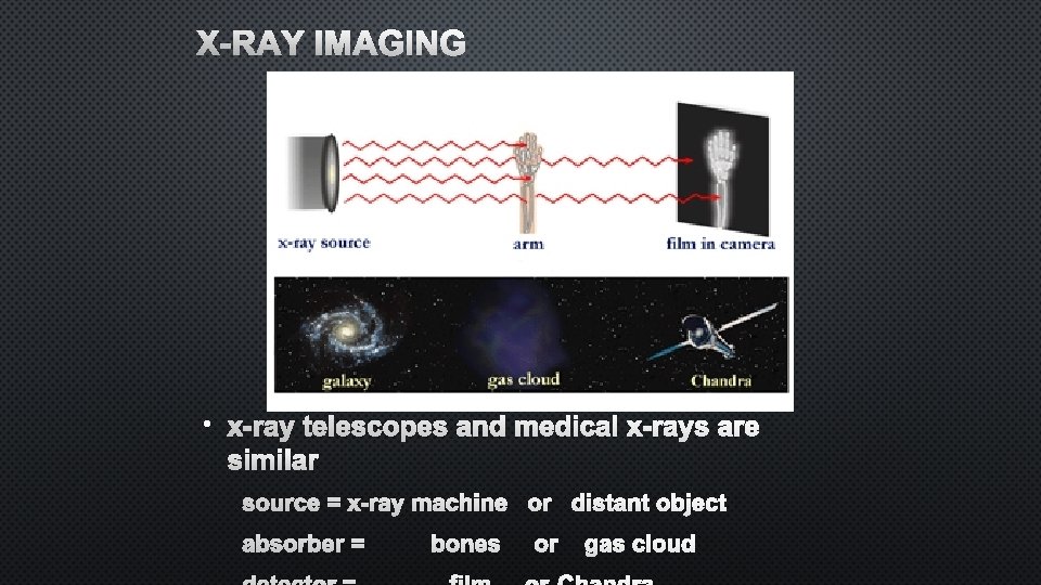 X-RAY IMAGING • X-RAY TELESCOPES AND MEDICAL X-RAYS ARE SIMILAR SOURCE = X-RAY MACHINE