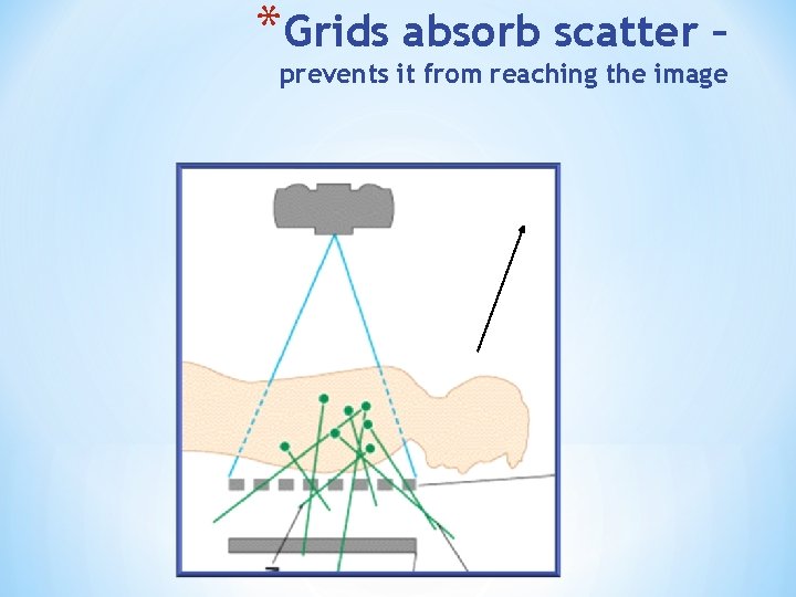 *Grids absorb scatter – prevents it from reaching the image 34 