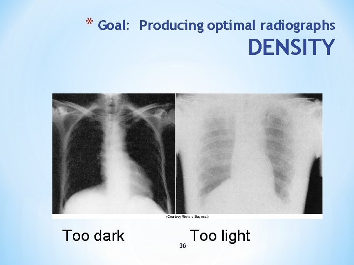 * Goal: Too dark Producing optimal radiographs DENSITY 36 Too light 