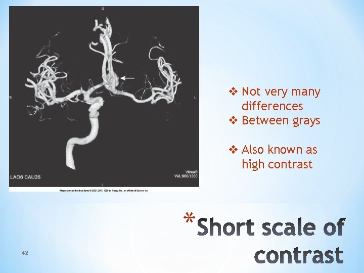 v Not very many differences v Between grays v Also known as high contrast