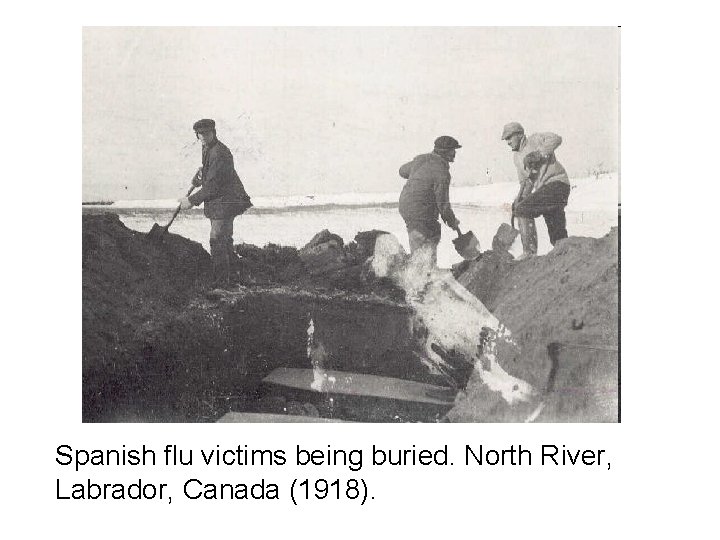 Spanish flu victims being buried. North River, Labrador, Canada (1918). 