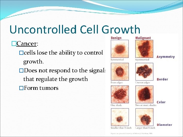 Uncontrolled Cell Growth �Cancer: �cells lose the ability to control growth. �Does not respond