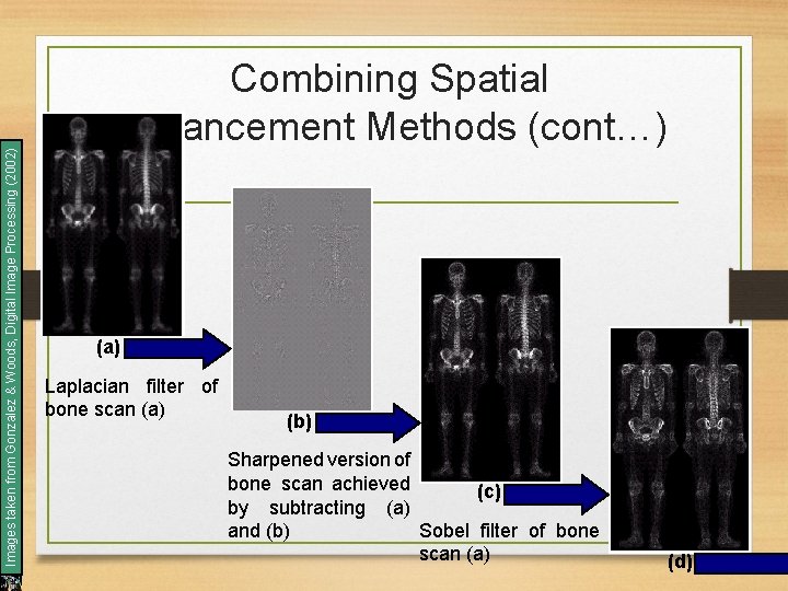 Images taken from Gonzalez & Woods, Digital Image Processing (2002) Combining Spatial Enhancement Methods