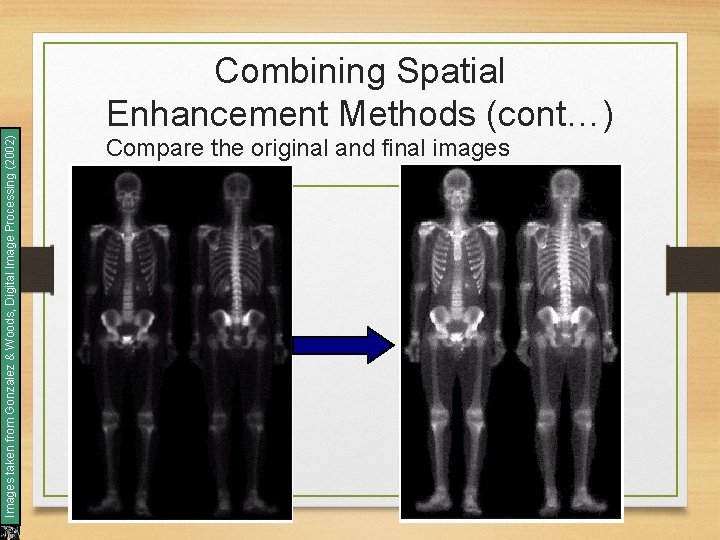 Images taken from Gonzalez & Woods, Digital Image Processing (2002) Combining Spatial Enhancement Methods