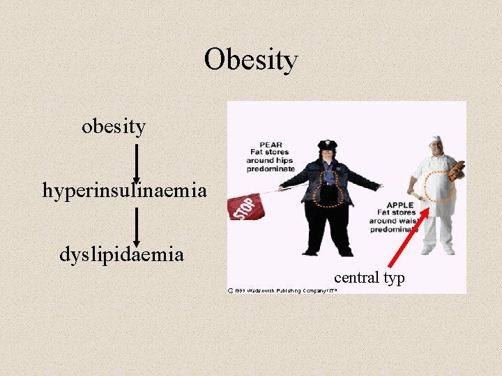 Obesity obesity hyperinsulinaemia dyslipidaemia central typ 