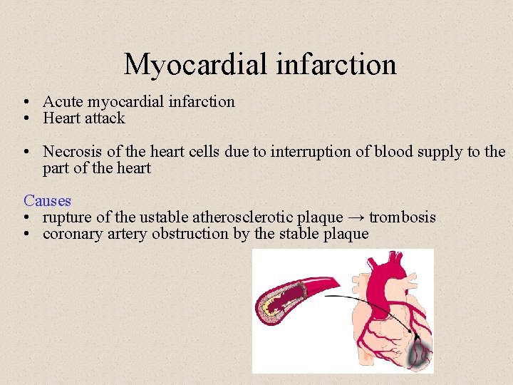 Myocardial infarction • Acute myocardial infarction • Heart attack • Necrosis of the heart