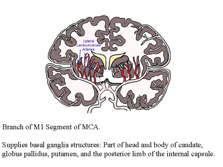 Branch of M 1 Segment of MCA. Supplies basal ganglia structures: Part of head