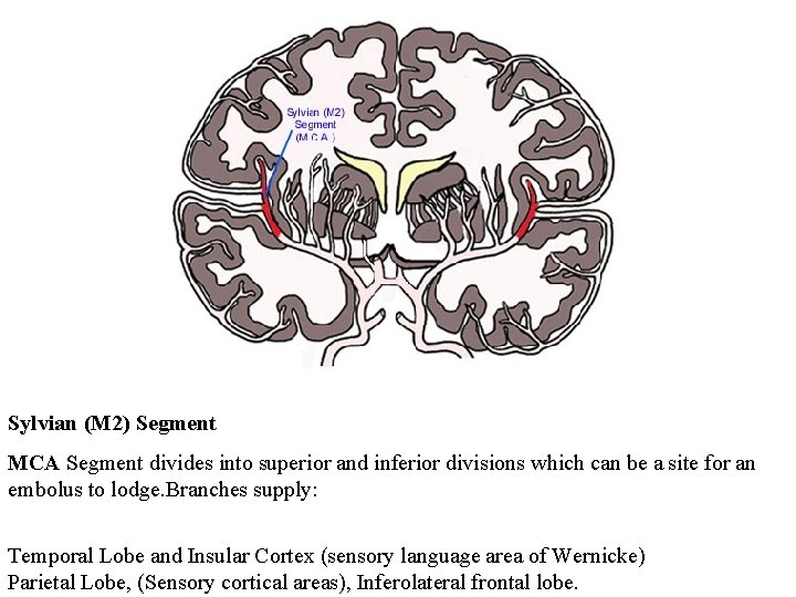 Sylvian (M 2) Segment MCA Segment divides into superior and inferior divisions which can