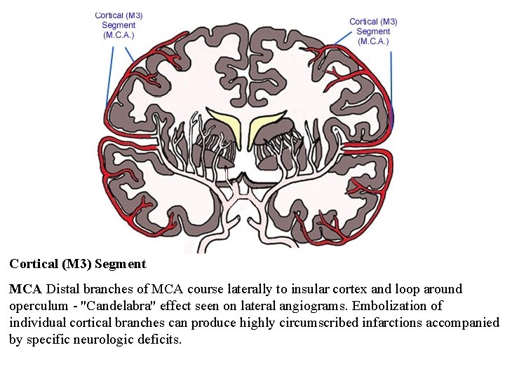 Cortical (M 3) Segment MCA Distal branches of MCA course laterally to insular cortex
