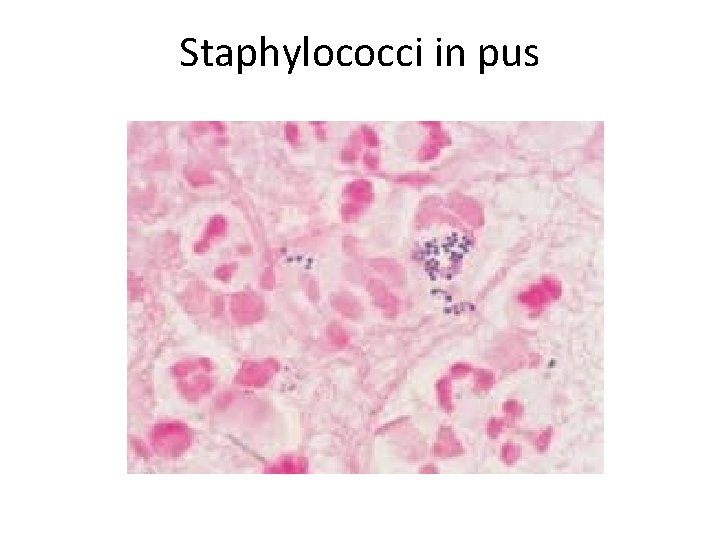 Staphylococci in pus 