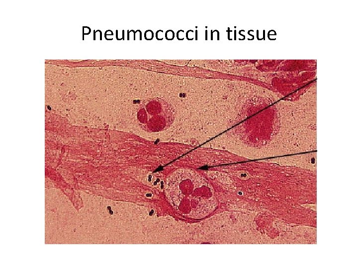 Pneumococci in tissue 