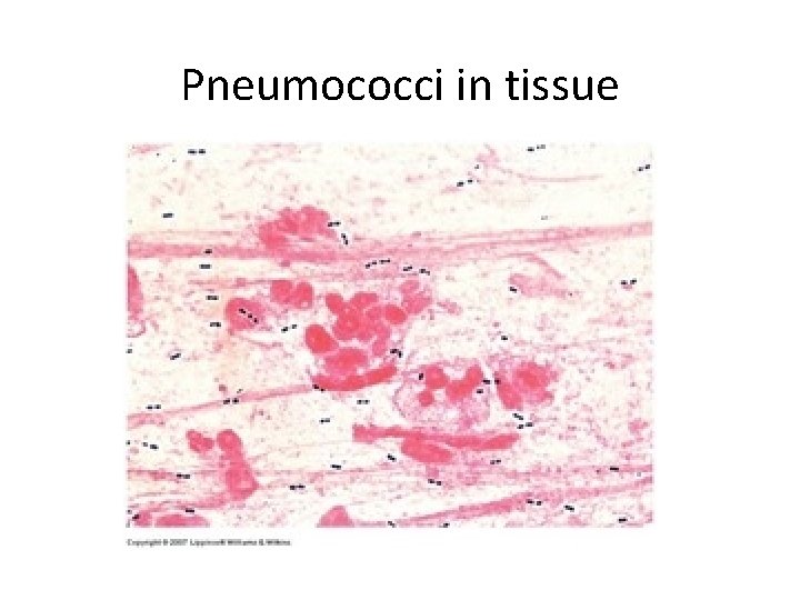 Pneumococci in tissue 