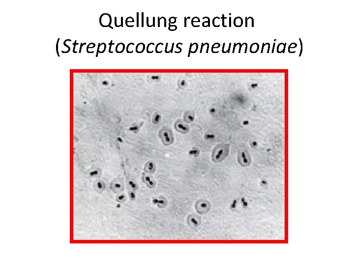 Quellung reaction (Streptococcus pneumoniae) 