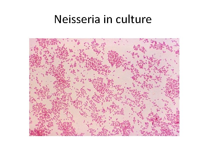 Neisseria in culture 