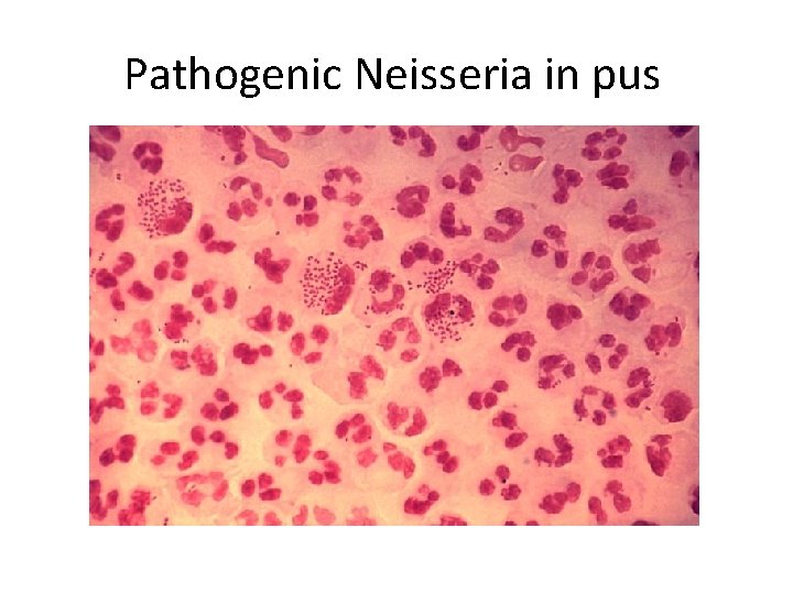 Pathogenic Neisseria in pus 