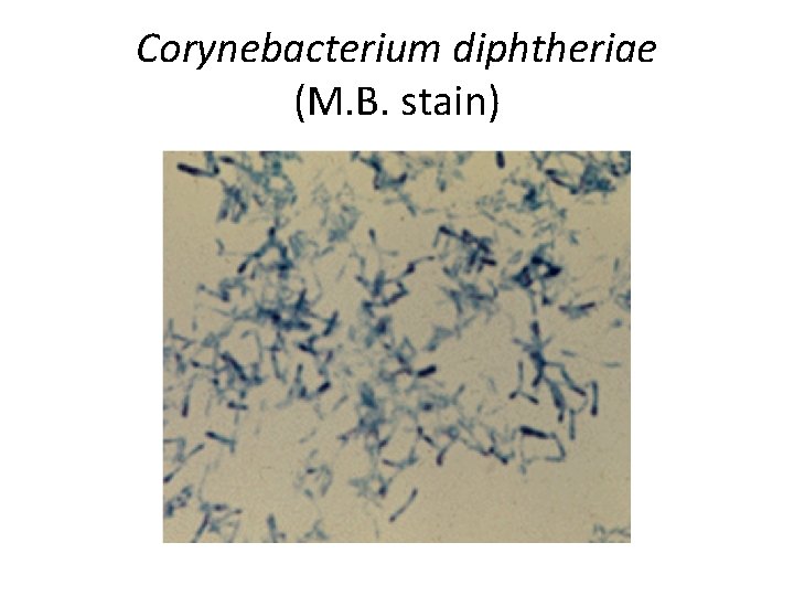 Corynebacterium diphtheriae (M. B. stain) 